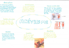 Anévrisme