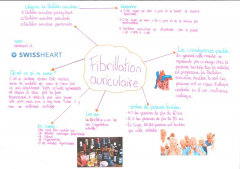 Fibrillation auriculaire