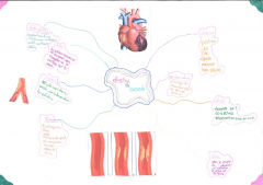 Infarctus du myocarde