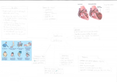 Insuffisance cardiaque