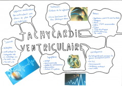 Tachycardie